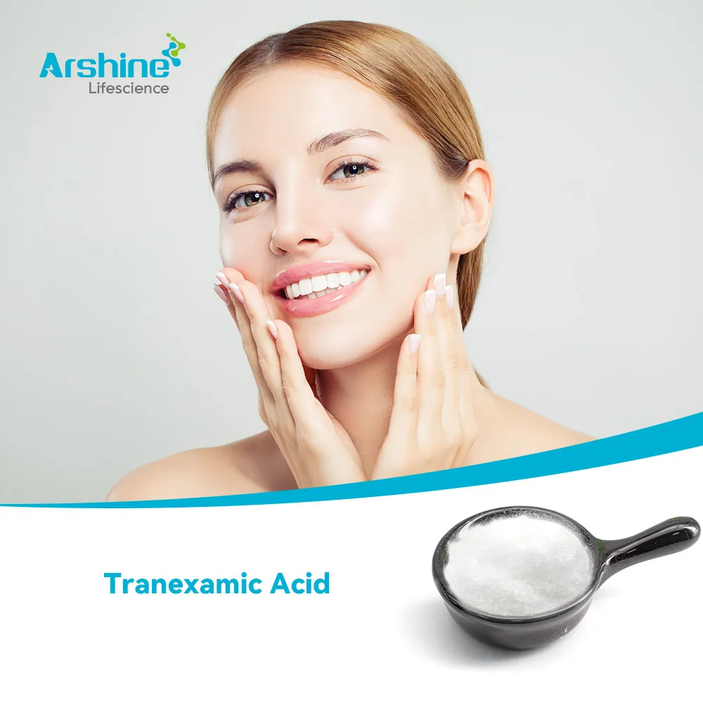 Ácido tranexámico (ácido trans-4-aminometilciclohexanocarboxílico)